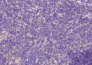 API5 Rabbit Polyclonal Antibody