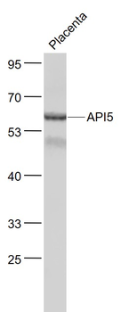 API5 Rabbit Polyclonal Antibody
