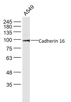Cadherin 16 Rabbit Polyclonal Antibody