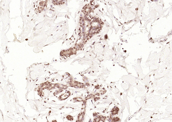 CDKN2A/p14ARF Rabbit Polyclonal Antibody
