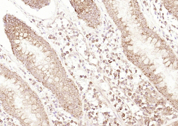 MAP3K9 Rabbit Polyclonal Antibody