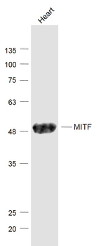 MITF Rabbit Polyclonal Antibody
