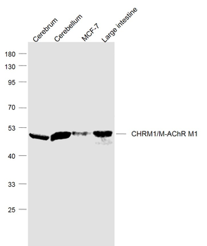 CHRM1/M-AChR M1 Rabbit Polyclonal Antibody