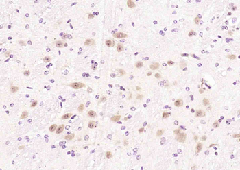 Smad3 Rabbit Polyclonal Antibody