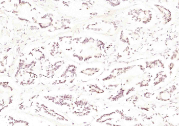 Aurora B Rabbit Polyclonal Antibody