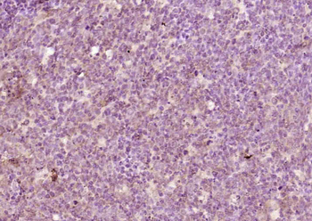 Aurora B Rabbit Polyclonal Antibody