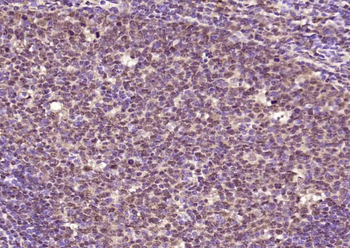 DRAK2 Rabbit Polyclonal Antibody