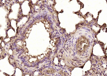 DRAK2 Rabbit Polyclonal Antibody