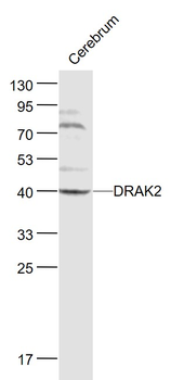 DRAK2 Rabbit Polyclonal Antibody