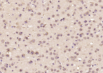 Artemin Rabbit Polyclonal Antibody