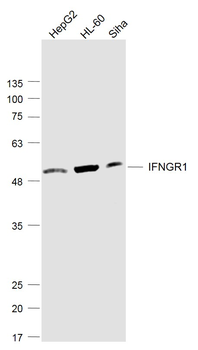 IFNGR1 Rabbit Polyclonal Antibody