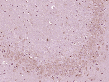 Urocortin 3 Rabbit Polyclonal Antibody