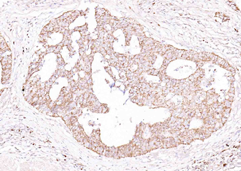 ULBP1 Rabbit Polyclonal Antibody