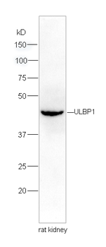 ULBP1 Rabbit Polyclonal Antibody
