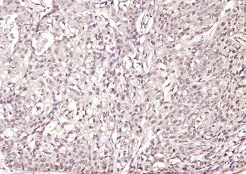 ErbB 4 Rabbit Polyclonal Antibody