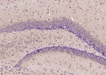 ErbB 4 Rabbit Polyclonal Antibody