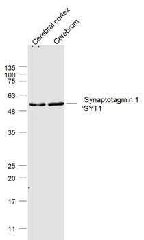 Synaptotagmin 1/SYT1 Rabbit Polyclonal Antibody