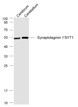 Synaptotagmin 1/SYT1 Rabbit Polyclonal Antibody