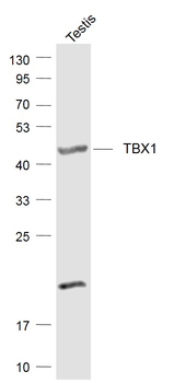 TBX1 Rabbit Polyclonal Antibody