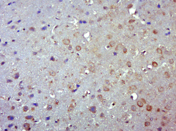 STAT3 Mouse Monoclonal Antibody