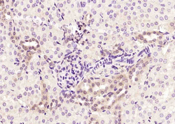 STAT3 Mouse Monoclonal Antibody