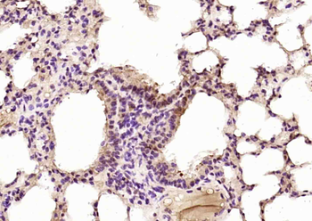 STAT3 Mouse Monoclonal Antibody