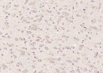 DCP1A Rabbit Polyclonal Antibody