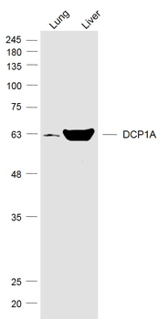 DCP1A Rabbit Polyclonal Antibody