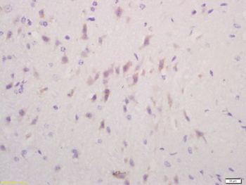 DCP1A Rabbit Polyclonal Antibody