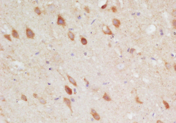 DCP1A Rabbit Polyclonal Antibody