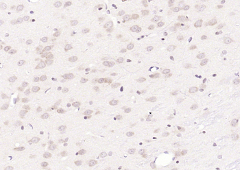 CHRNB2 Rabbit Polyclonal Antibody