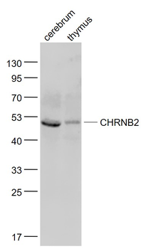 CHRNB2 Rabbit Polyclonal Antibody