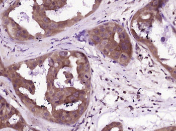 Phospho-VASP (Ser157) Rabbit Polyclonal Antibody