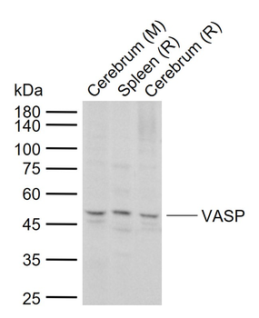 Phospho-VASP (Ser157) Rabbit Polyclonal Antibody