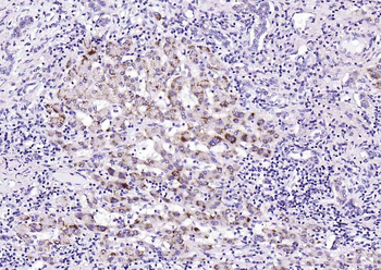 LAMP2 Rabbit Polyclonal Antibody