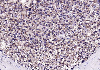 LAMP2 Rabbit Polyclonal Antibody