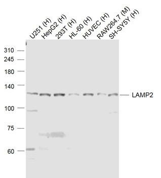 LAMP2 Rabbit Polyclonal Antibody