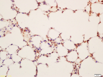 LAMP2 Rabbit Polyclonal Antibody