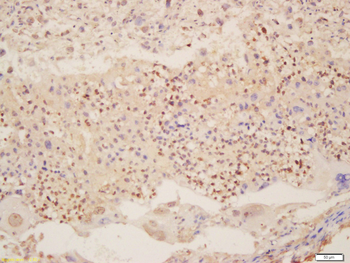 LAMP2 Rabbit Polyclonal Antibody