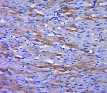 Phospho-VEGFR2 (Tyr951) Rabbit Polyclonal Antibody