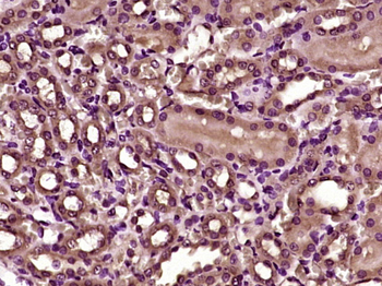 Villin Rabbit Polyclonal Antibody