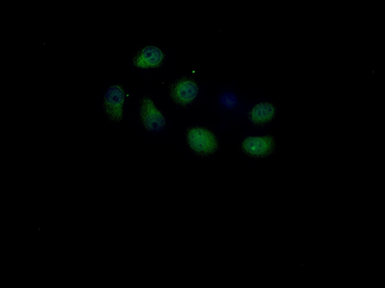 YAP1 Rabbit Polyclonal Antibody