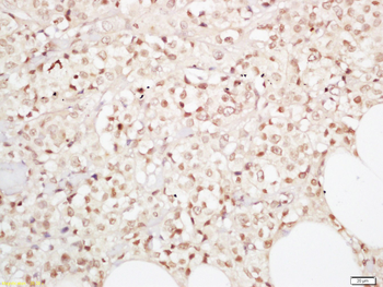 YAP1 Rabbit Polyclonal Antibody