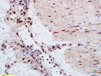 YAP1 Rabbit Polyclonal Antibody