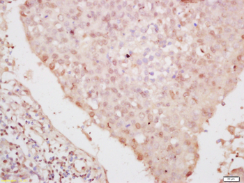 Phospho-YAP1 (Ser127) Rabbit Polyclonal Antibody