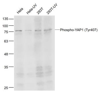Phospho-YAP1 (Tyr407) Rabbit Polyclonal Antibody