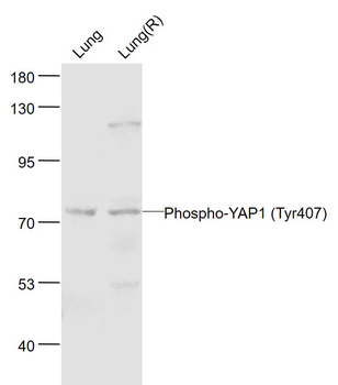 Phospho-YAP1 (Tyr407) Rabbit Polyclonal Antibody