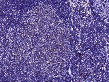 Phospho-YB1 (Ser102) Rabbit Polyclonal Antibody