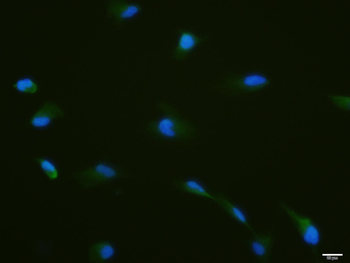 Phospho-YB1 (Ser102) Rabbit Polyclonal Antibody