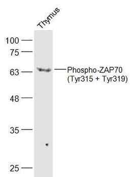 Phospho-ZAP70 (Tyr315 + Tyr319) Rabbit Polyclonal Antibody